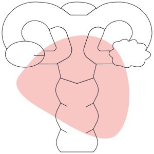 ovario-poliquistico